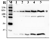 CrPDAT1 | Phospholipid: diacylglycerol acyltransferase in the group Antibodies Plant/Algal / Plant Developmental Biology / Lipid metabolism at Agrisera AB (Antibodies for research) (AS12 1875)
